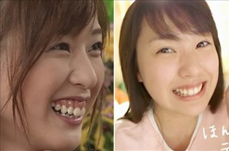 戸田恵梨香 整形