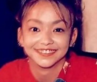 安室奈美恵 整形