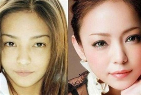 安室奈美恵 整形