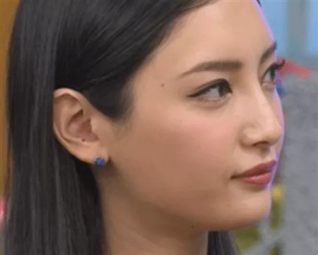 菜々緒 整形 劣化