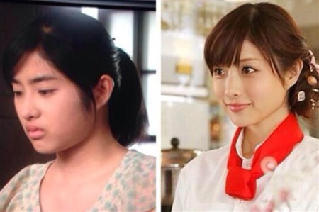 石原さとみ 整形 劣化