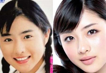 石原さとみ 整形 劣化