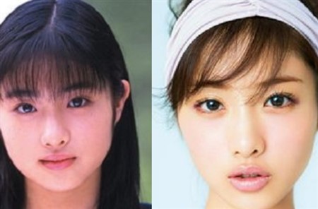 石原さとみ 整形 劣化