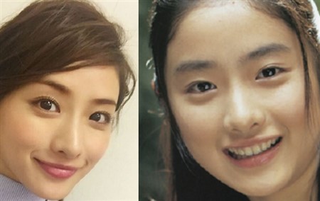 石原さとみ 整形 劣化