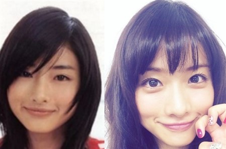 石原さとみ 整形 劣化