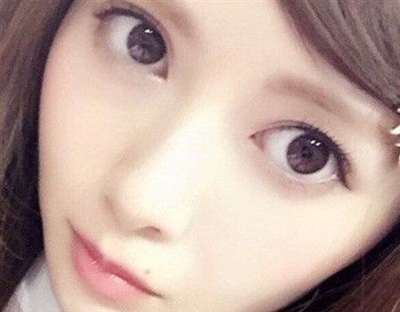 白石麻衣 整形 劣化