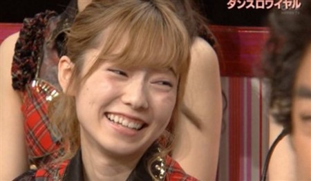 島崎遥香 整形 劣化