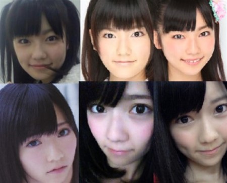 島崎遥香 整形 劣化