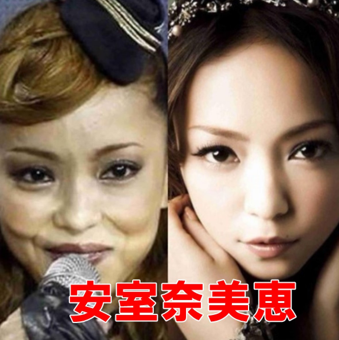 安室奈美恵が整形して劣化がヤバイ?目や鼻、顎を昔の画像で徹底検証